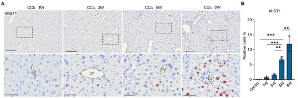 (A) CCI4 투여 후 시간에 따른 MIST1 발현의 면역조직화학염색 결과. (B) CCI4 주입 후 주차가 지날수록 MIST1 유전자의 발현이 높게 나타났다.