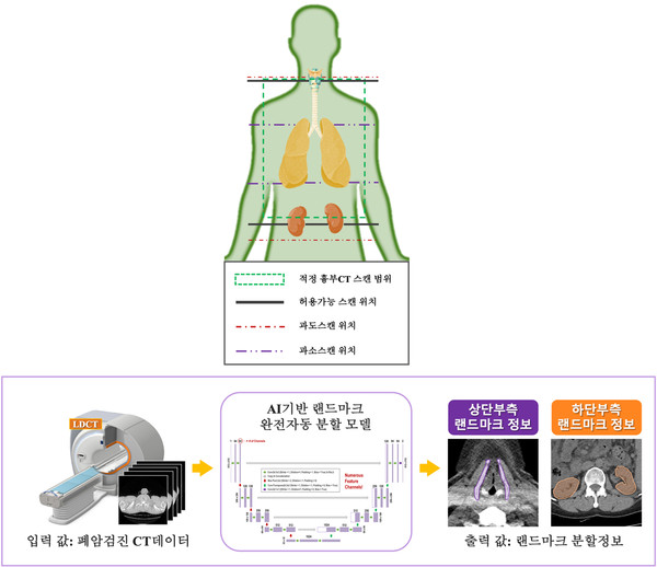 적정 흉부CT 스캔 범위 및 AI기반 랜드마크 분할의 프로세스