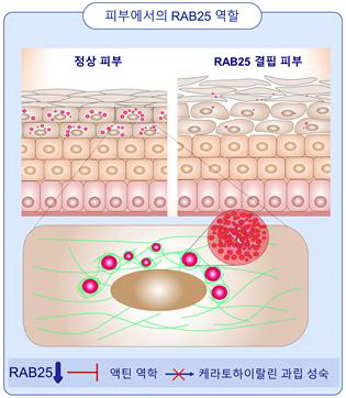 RAB25가 결핍되면 세포 운동성이 떨어져 케라토하이알린과립 성장이 저해되는 것으로 확인됐다.
