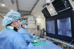 세브란스병원 신경외과 박근영 교수(사진 오른쪽)가 뇌혈류차단기 삽입술을 시행하고 있다.