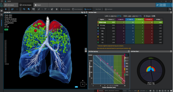 코어라인소프트 AVIEW COPD 화면 모습