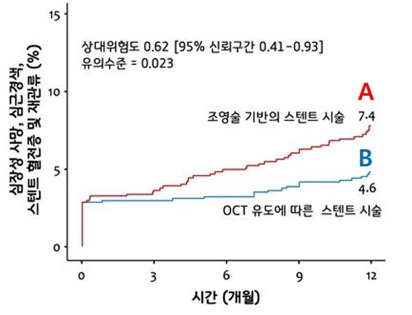 기존의 치료법(A)과 OCT 유도 중재술(B) 간 합병증 발생률 비교